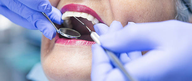 Best Emergency Dentist for Lost Fillings or Crowns in Niwot, CO